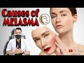 FLEK HITAM MELASMA PADA WAJAH | NATASHA SKIN CARE PADANG | dr. JEFFRY