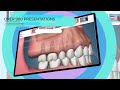 Consult-PRO: Software For Dentists | Case Presenter | Patient Education Web Application