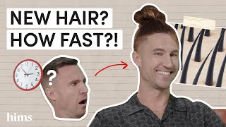 How Fast Does Minoxidil Work? A Doctor Explains Minoxidil Results