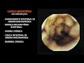 Métodos e Diagnósticos Utilizados para Investigação de Doenças do Intestino Delgado