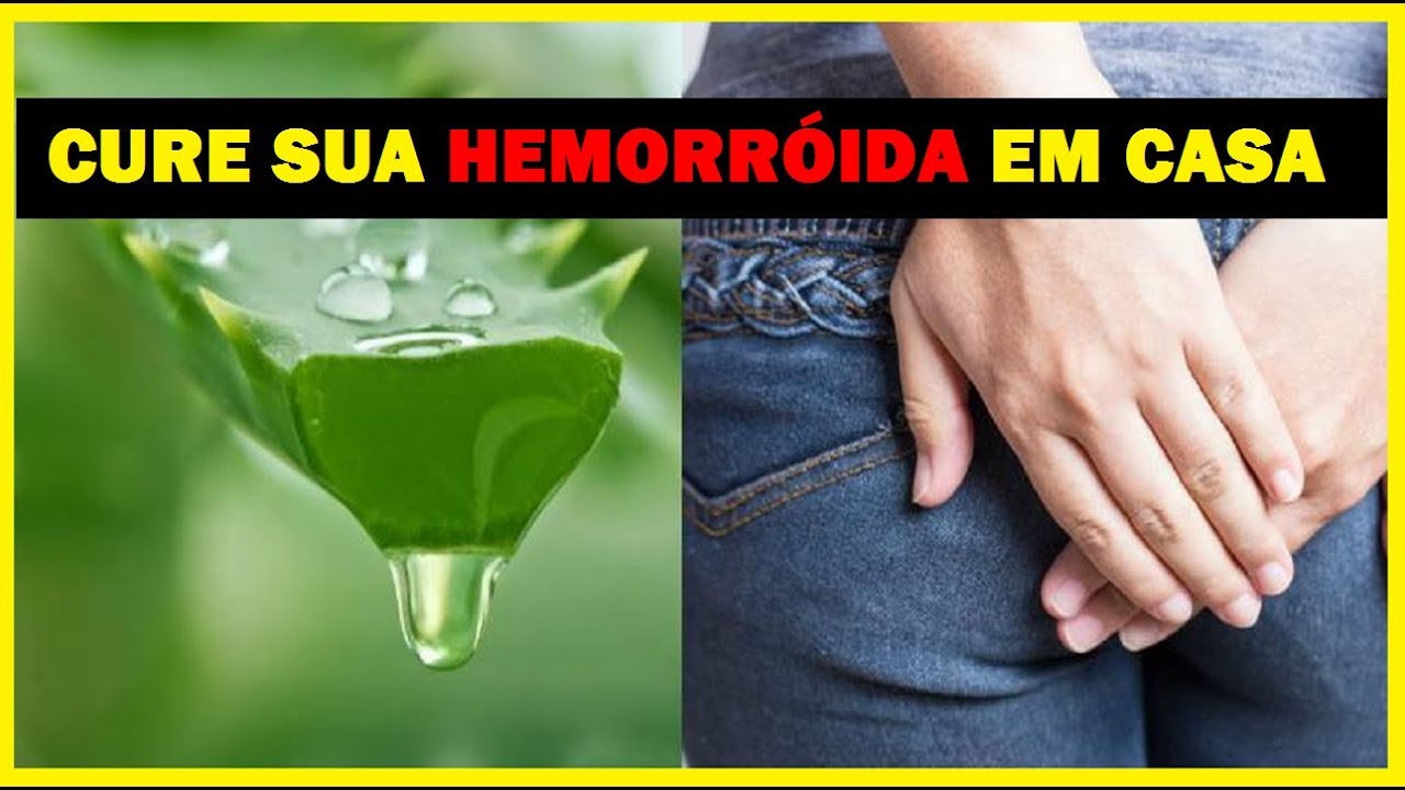 Como Acabar Com Hemorroida De Forma Natural - SixSigmadss