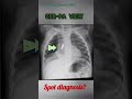 👩‍⚕️clinical viva xray 😱 spot diagnosis shorts mbbs medicalstudent