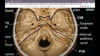 L6 Radiology:Head and Neck ( Psychicatry , cl.p and radio ) 42