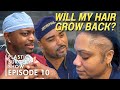 Got Alopecia? || Beyond the Surface (S1 Ep10)