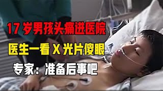 17岁男孩头痛进医院，医生一看X光片直接傻眼，专家：准备后事吧