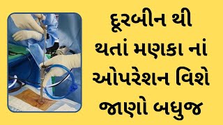 દૂરબીન થી થતી સ્પાઈન સર્જરી #backpain #slipdisc #sciatica #spinehealth #legpain #endoscopicspine