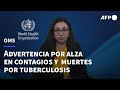 La OMS dice que la tuberculosis vuelve a propagarse en el mundo | AFP