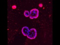 3D image of Breast Cancer cells in a petri dish.