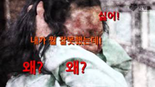 간질발작 때문에 끓는 냄비에 얼굴이 들어간 소녀