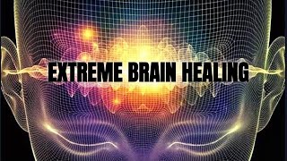 EXTREME BRAIN HEALING In 30 Minutes - Powerful Neuroplasticity Stimulation - Purest RIFE Frequency