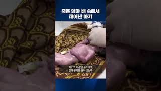 숨진 엄마 배 속에서 아기 살려낸 가자지구 의료진 #shorts / KBS