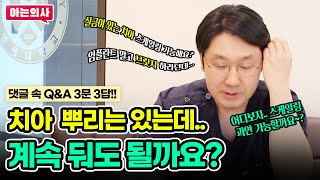 치아뿌리 최대한 그냥 두는게 나을까요? 댓글에 답해드립니다 3문 3답!