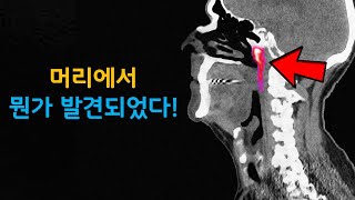 과학자들은 우리의 머리에서 지금까지 몰랐던 새로운 기관을 발견했습니다.