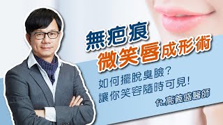 【風華聯合診所】笑容隨時可見，無疤痕微笑唇提嘴角手術｜高義盛醫師｜風華整形外科診所｜