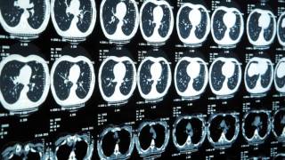 Stanford Certificate - Biomedical Engineering: Imaging, Devices and Systems