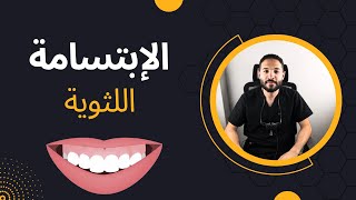 الابتسامة اللثوية: الأسباب، الأعراض، وأفضل طرق العلاج - احصل على ابتسامة مثالية