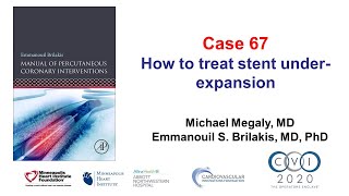 Case 67 - PCI Manual - How to treat under-expanded stents