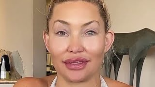 The Ugliest Celebs After Plastic Surgery DESTROYED Their Faces