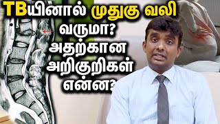 TBயினால் முதுகு வலி வருமா? அதற்கான அறிகுறிகள் என்ன? Can TB Cause Back Pain?  Symptoms in Tamil