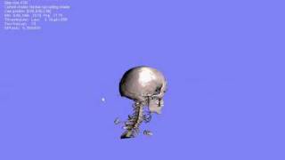 GPU based ray casting with iso-surface ray function