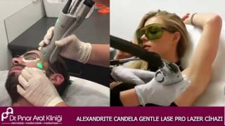 Ümraniye Candela Gentle Lase Pro Alexandrite lazer