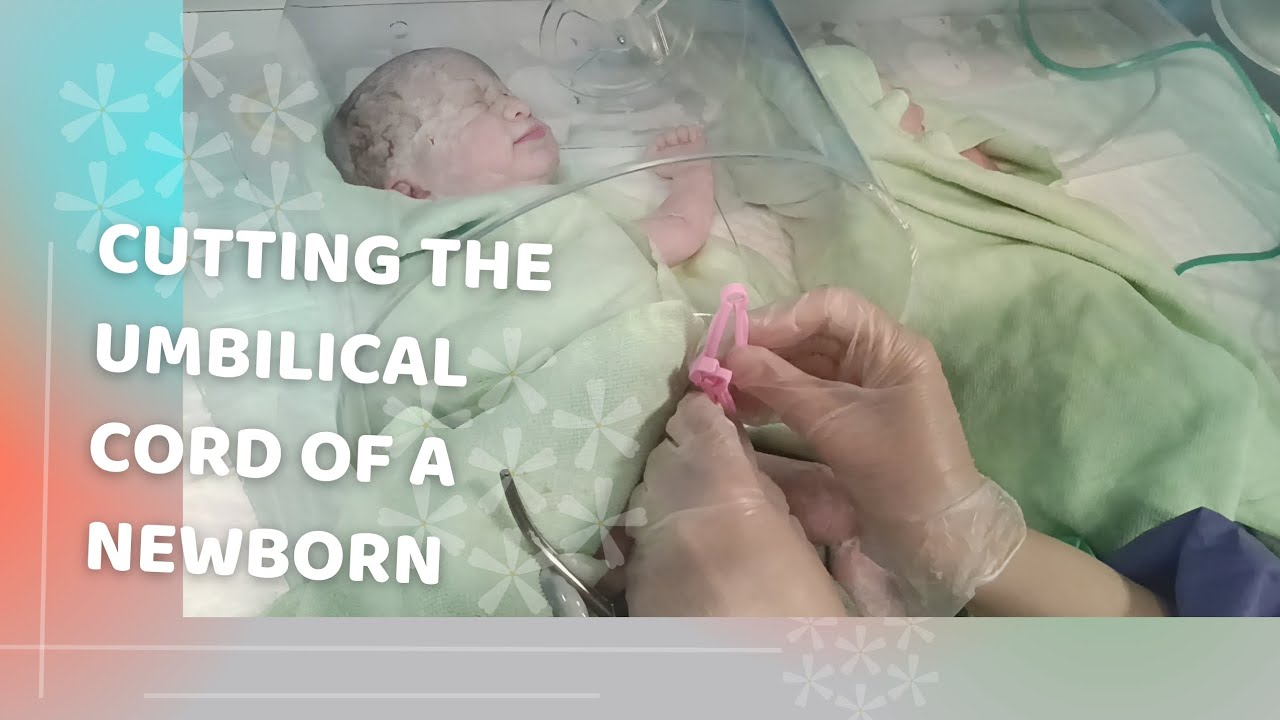 Cutting The Umbilical Cord Of A Newborn - YouTube