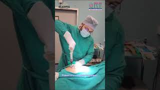 Magic Of Bone Marrow Aspiration | Explained By Dr Mannan Gupta | Elantis Healthcare