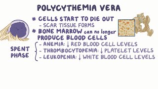 Polycythemia Vera: Causes, Symptoms & JAK2 Mutation