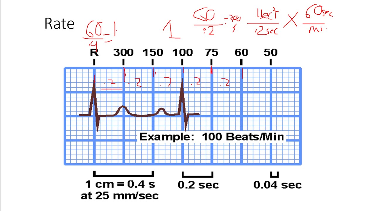 Ecg Interpretation Cheat Sheet Pdf Electrocardiography 45 Off