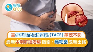 醫師Easy【中期肝癌治療的新出路】｜饒家棟醫學博士訪問