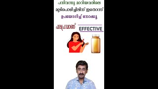 പനിവന്നു മാറിയവരിലെ മുടിപൊഴിച്ചിലിന് ഇതൊന്ന് ഉപയോഗിച്ച് നോക്കൂ ഫലപ്രദമാണ്#short #healthtips