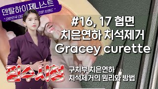 16, 17 협면 구치부 치은연하 치석제거의 원리와 방법 Gracey curette  | 치과위생사 실기시험  그레이시 큐렛