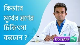 কিভাবে মুখের  ব্রণের চিকিৎসা করবেন? #AsktheDoctor