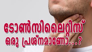 Howtotreat tonsillitis|dr.k.Muraleedharan pillai|Symptoms of tonsillitis|Ayursopanam