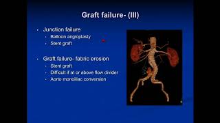 Treatment of Endoleaks: When and How to Intervene - Norman Kumins, MD