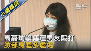 高嘉瑜驚傳遭男友毆打 臉部身體多處傷｜TVBS新聞