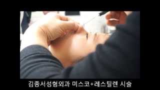 미스코 + 레스틸렌 코필러 동영상/ 김종서성형외과 (Nose filler with PDO insertion)