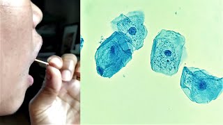 Cheek Epithelial Cell Practical Experiment