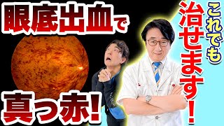 【網膜剥離】網膜にむくみ？生活習慣と目の深い関係について眼科医が解説します！