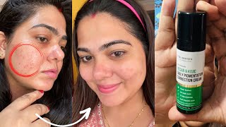 Dr. Sheth's Kojic Daily Correction Cream Review pigmentation | dark spots | acne marks for oily skin