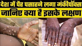 Delhi में Monkeypox की दहशत, बढ़ रही मरीज़ों की संख्या | Monkeypox in Delhi | Monkeypox Virus क्या है?