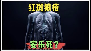 女子因为红斑狼疮安乐死？红斑狼疮科普