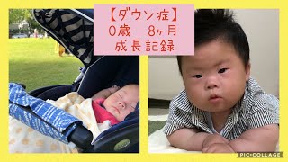 【ダウン症】0歳8ヶ月成長記録