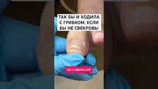 Эффективное средство от грибка ногтей. Артикул - 67774905