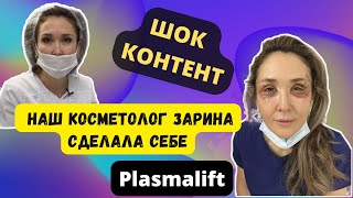 Плазмалифт - безоперационная блефаропластика. Показываем как это было