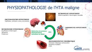 3 16 2 Urgence hypertensive : diagnostic et prise en charge immédiate