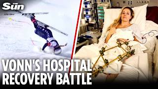 Lindsey Vonn sends message from hospital after THIRD surgery following Winter Olympics horror crash