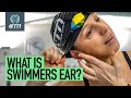 How To Treat & Prevent An Ear Infection From Swimming