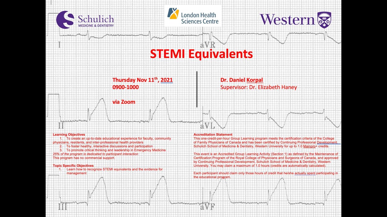 Dr. Daniel Korpal: STEMI Equivalents - YouTube