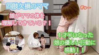 四肢欠損のママ〜娘がママの体を理解してきている？！〜１才半になった娘の優しい行動に感動！！